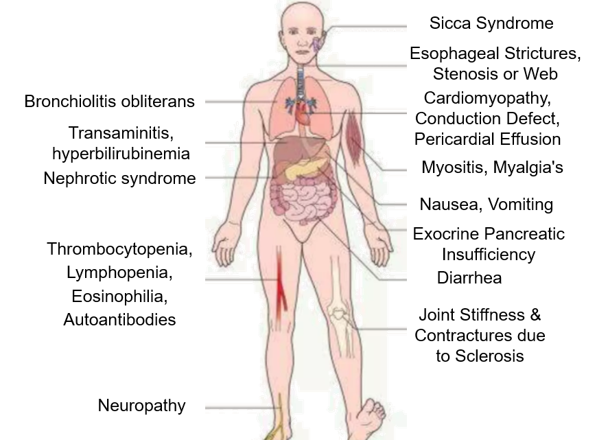 Multi-organ Manifestations of Chronic GVHD