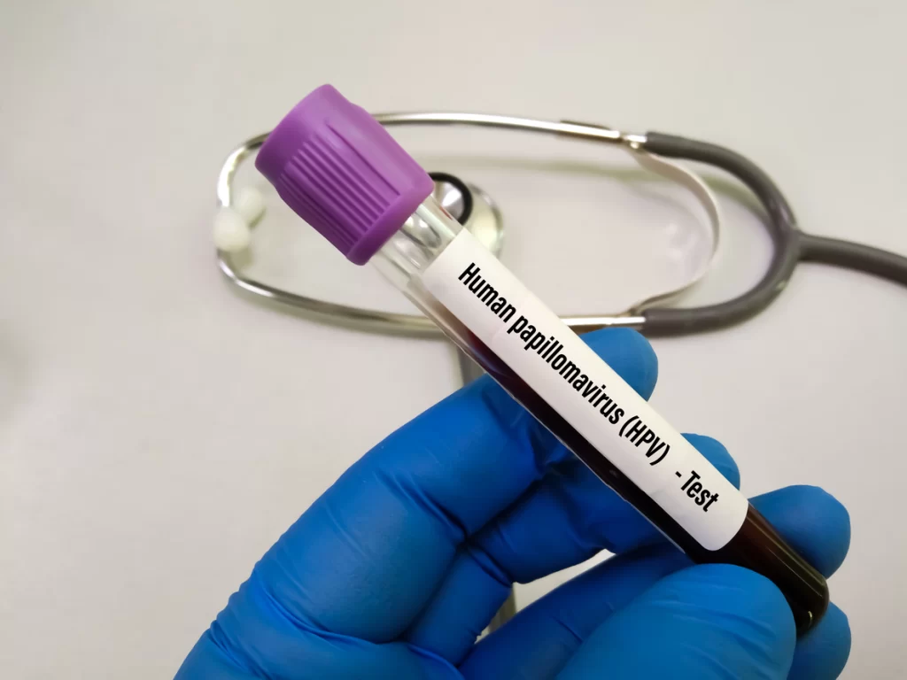 Five Levers for MedTech OEMs in the Era of Decentralized Diagnostics