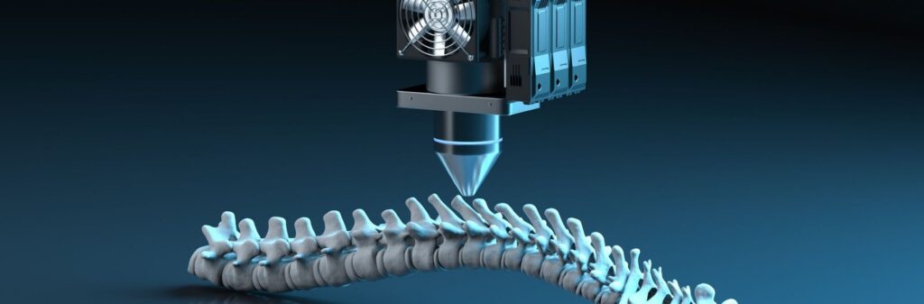 How Personalized Implants Are Rewiring Supply Chains and Operational Pricing Models of MedTech Firms
