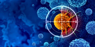 Market Assessment and Capacity Planning for Pancreatic Cancer CDMO Entry